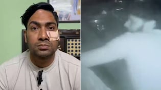 Delhi Cop Thrashed With Baseball Bat After Argument, Gets 5 Stiches Near Eye