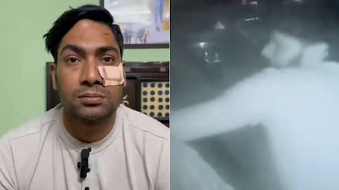 Delhi Cop Thrashed With Baseball Bat After Argument, Gets 5 Stiches Near Eye