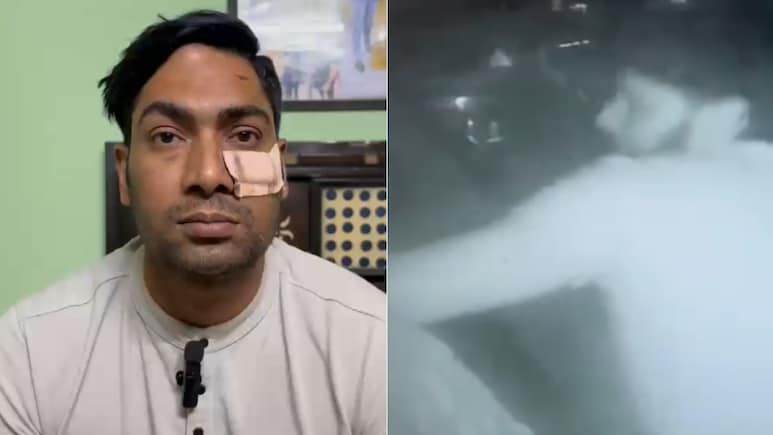 Delhi Cop Thrashed With Baseball Bat After Argument, Gets 5 Stiches Near Eye