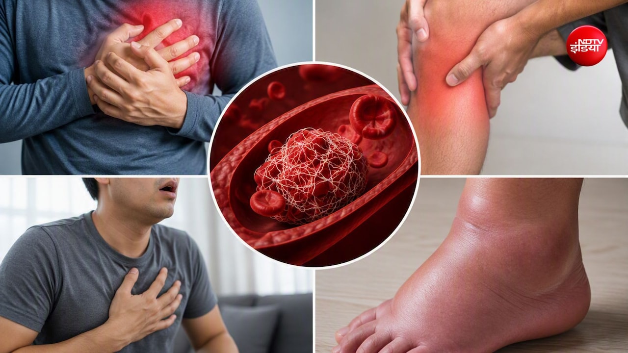 ब्लड क्लॉट बनने से पहले शरीर कौन-कौन से वॉर्निंग संकेत देता है? 