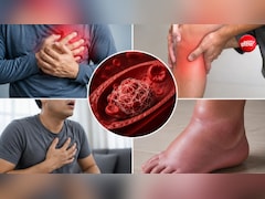 ब्लड क्लॉट बनने से पहले शरीर कौन-कौन से वॉर्निंग संकेत देता है? 