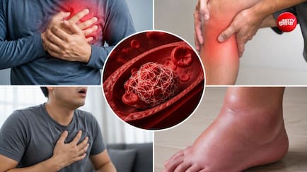 ब्लड क्लॉट बनने से पहले शरीर कौन-कौन से वॉर्निंग संकेत देता है?