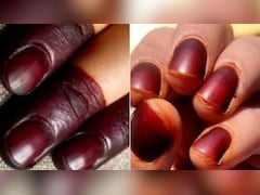 नाखूनों पर मेहंदी लगाना कितना सही है? स्किन एक्सपर्ट ने बताया मेहंदी लगाने से Nails पर कैसा असर होता है
