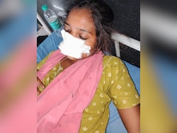 Telangana Man Bites Off Wife's Nose After She Refuses To Return Home