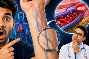 नसें नीली क्यों दिखती हैं, लाल क्यों नहीं?