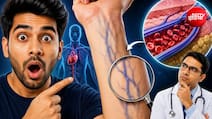 नसें नीली क्यों दिखाई देती हैं, लाल क्यों नहीं? डॉक्टर से समझे इसके पीछे का साइंस