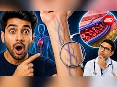 नसें नीली क्यों दिखाई देती हैं, लाल क्यों नहीं? डॉक्टर से समझे इसके पीछे का साइंस