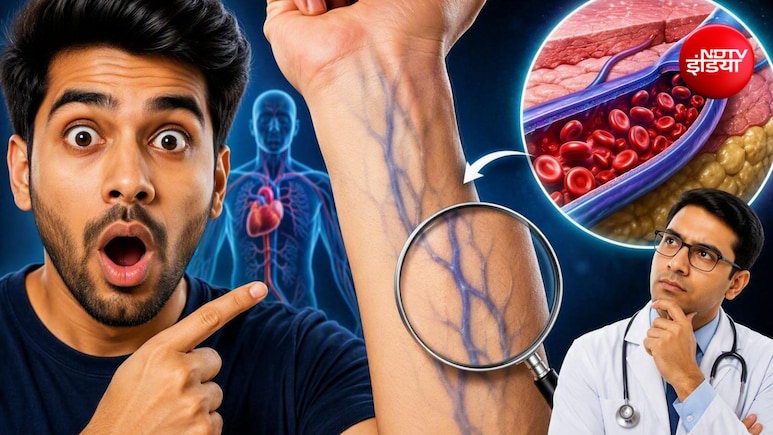 नसें नीली क्यों दिखती हैं, लाल क्यों नहीं?