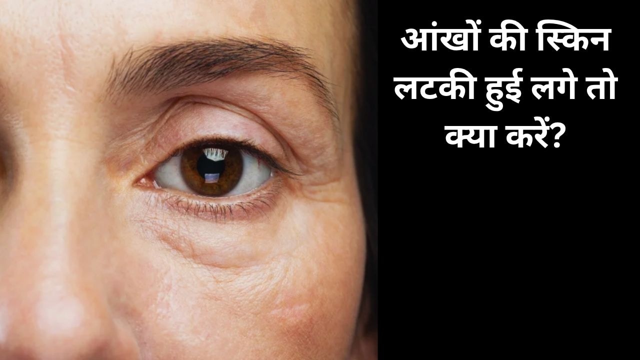 आंखों के नीचे की स्किन लटकने लगी है? एक्सपर्ट से जानें आंखों के नीचे ज्यादा पफीनेस दिखे तो क्या करें