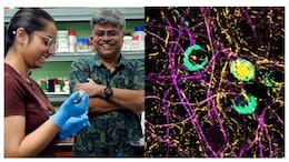 New Study Explains How Viral Infections May Trigger Parkinson's-Linked Protein Changes