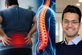 मोटापा कैसे बढ़ाता है रीढ़ की हड्डी की बीमारियों और लगातार रहने वाले कमर दर्द का खतरा?