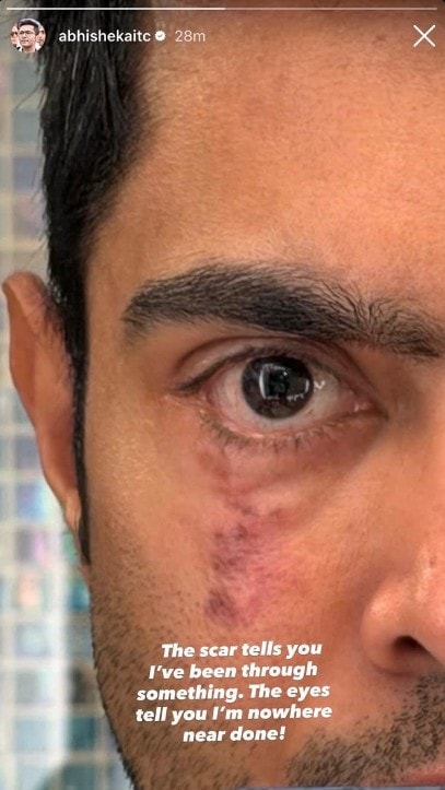 The picture Abhishek Banerjee put up on his Instagram story
