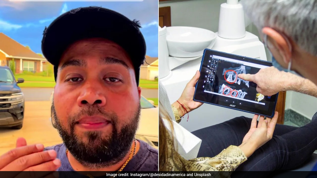 Watch: Man Shocked By Rs 2.37 Lakh Dental Bill In US, Compares Cost With India