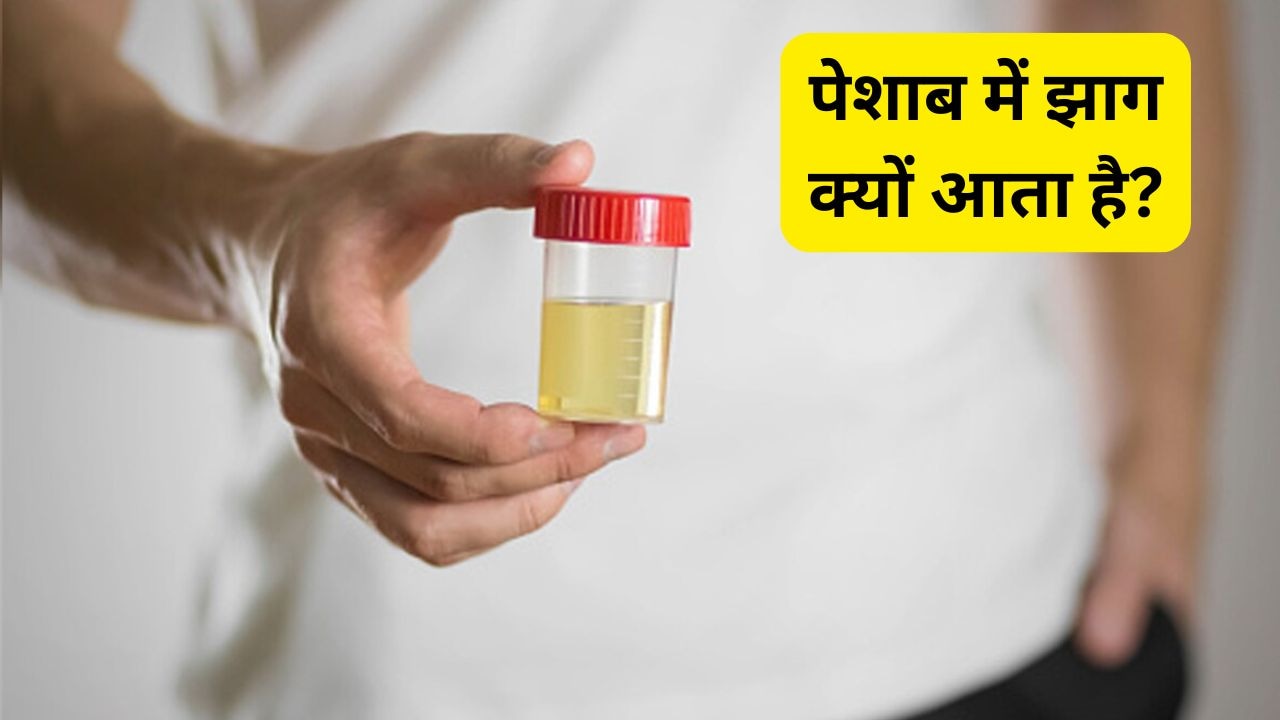 पेशाब में झाग क्यों आता है? यूनानी डॉक्टर से जानें इसके कारण, संकेत और घरेलू उपाय