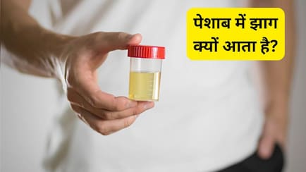पेशाब में झाग क्यों आता है? यूनानी डॉक्टर से जानें इसके कारण, संकेत और घरेलू उपाय