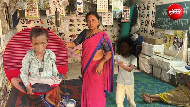 'मेरा बेटा चला गया, वह बहुत कमजोर था'; MP में कुपोषण से जान गंवाने वाले सनम के पिता का दर्द&nbsp;
