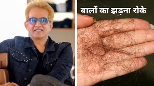 हेयर एक्&zwj;सपर्ट जावेद ने कहा कंघी करते ही बालों का लग जाता है ढेर, तो ये 5 तरीके आजमाइए, बालों का झड़ना हो जाएगा बंद