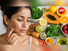 चेहरे की झाइयां कम करने के लिए क्या-क्या खाएं? डर्मेटोलॉजिस्ट ने बताई ऐसी डाइट, जिनसे दाग-धब्बे हो जाएंगे गायब