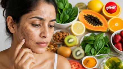चेहरे की झाइयां कम करने के लिए क्या-क्या खाएं? डर्मेटोलॉजिस्ट ने बताई ऐसी डाइट, जिनसे दाग-धब्बे हो जाएंगे गायब