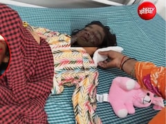 बिल्ली को बचाने कुत्ते से‍ भिड़ी 4 साल की मासूम, उसने बुरी तरह नोंचा, बहन की हिम्मत से बची जान, चेहरे पर जख्म