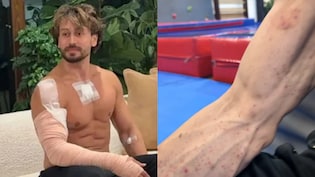 Video: Tiger Shroff Gives Fans A Closer Look At His Injuries After Assassination Bid