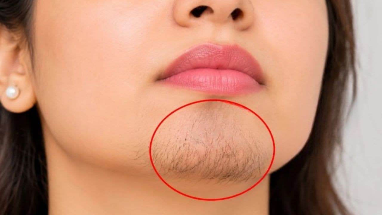 ठुड्डी पर बाल आना कैसे कम करें? एक्सपर्ट ने बताए 2 असरदार तरीके