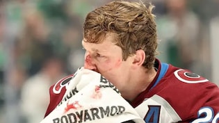 Nathan MacKinnon Left Bloody After Heated Fight As Avalanche Escape With Win Over Stars