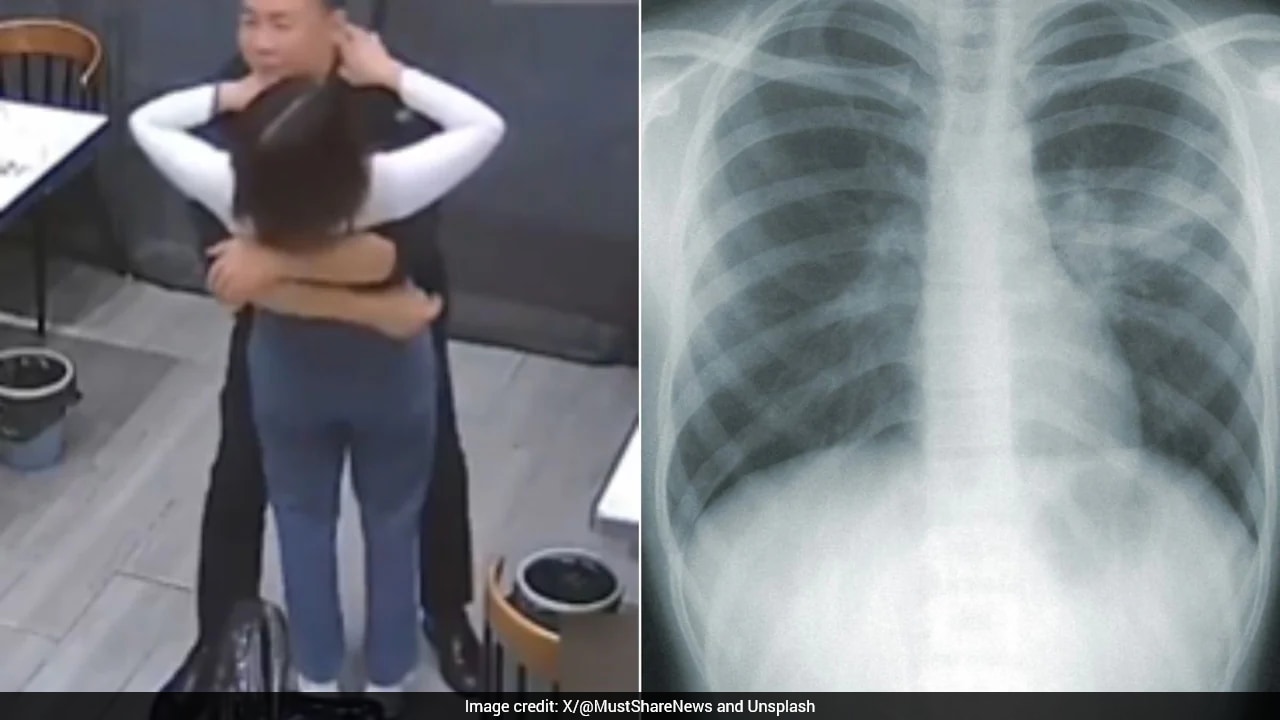 Chinese Woman Suffers Five Broken Ribs After Husband Hugs Her Tight