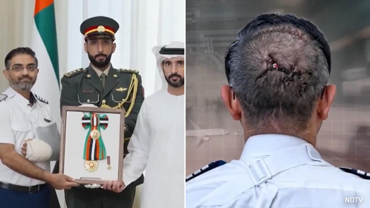 In First Visuals Of Captain Smit Machchhar's Injury, Stitches Seen On Head