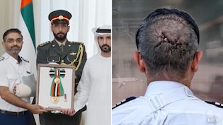 Stitches Across His Head: First Close-Up Look At Captain Smit Machchhar After Cockpit Attack