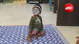 धार में कुपोषण की मार: 25 हजार बच्चे कुपोषित, 5 हजार से ज्यादा अति गंभीर श्रेणी में; पोषण व्यवस्था पर उठे सवाल