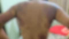 'Thrashed With Cooker, Belt': Kerala Woman Claims Assault By Husband In Saudi