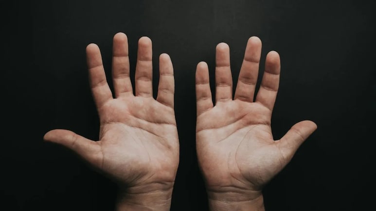Palmistry: हथेली पर ज्यादा बारीक रेखाएं होने का क्या है मतलब? जानें हस्तरेखा शास्त्र की मान्यता