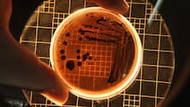 Plague Is A Bacterial Infection: Bubonic, Pneumonic, Septicemic Plague