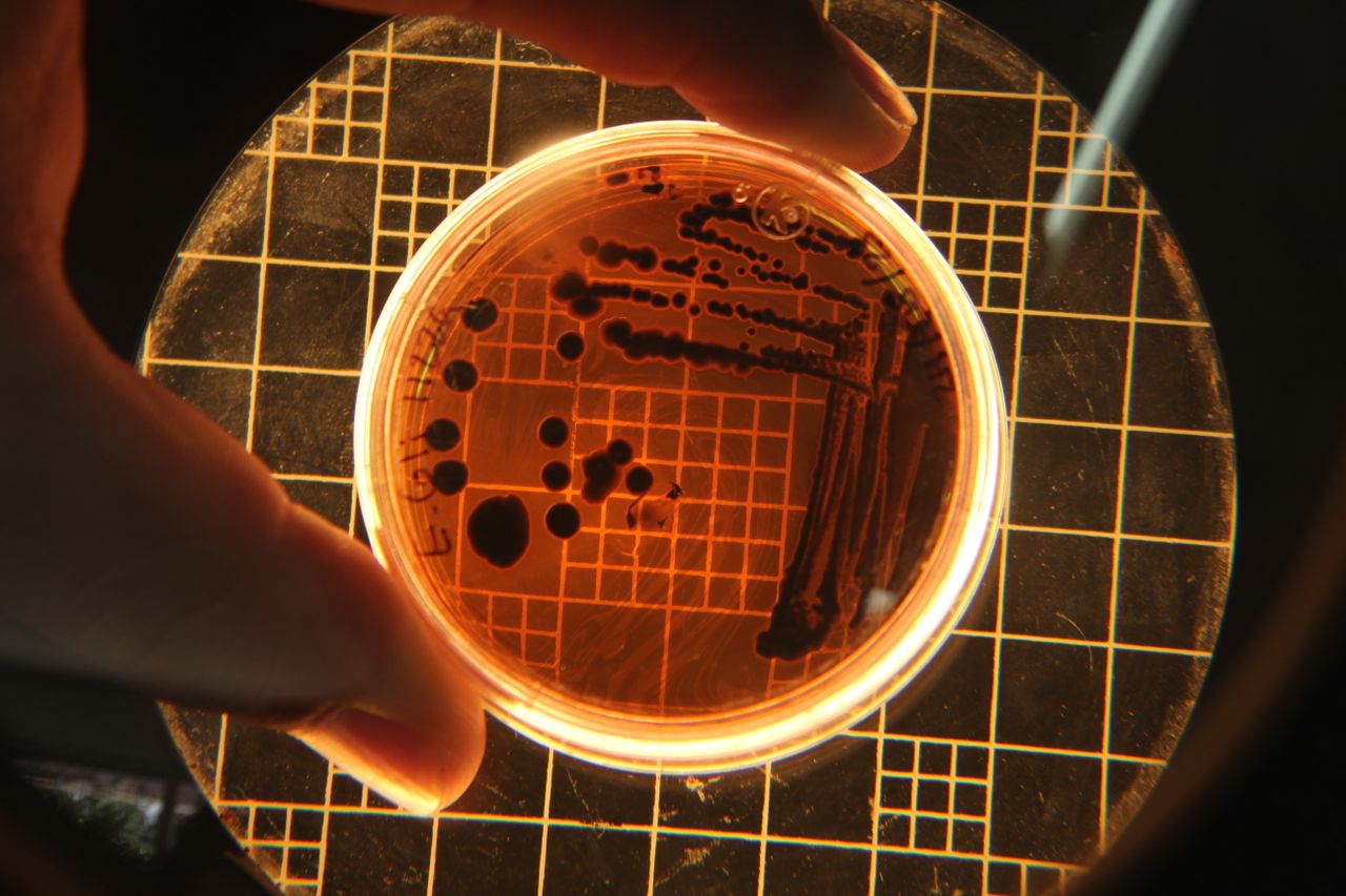 The study focused on a bacterial immune system called CBASS
