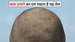 गंजे सिर पर जल्दी बाल कैसे उगाएं? एलोवेरा और मेथी का यह जादुई तेल उगा देगा काले और घने बाल, ऐसे बनाएं