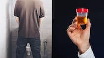 यूरिन से बदबू आने का क्या मतलब होता है? डॉक्टर ने बताया कब है चिंता की बात