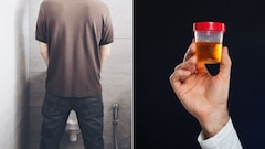 यूरिन से बदबू आने का क्या मतलब होता है? डॉक्टर ने बताया कब है चिंता की बात