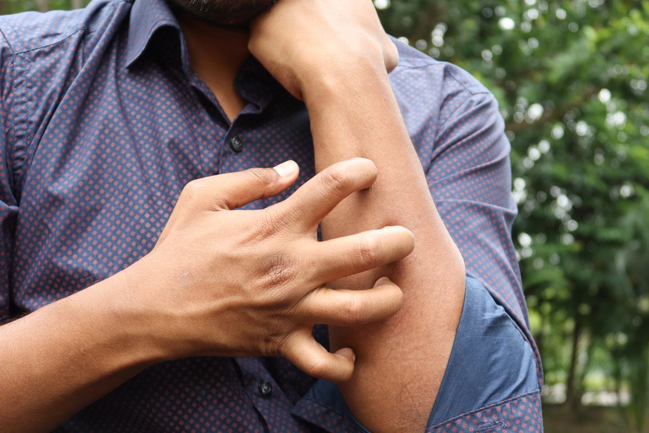 Living With Constant Itching And Hives? When To See A Dermatologist