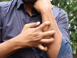 Living With Constant Itching And Hives? Here's When You Should See A Dermatologist