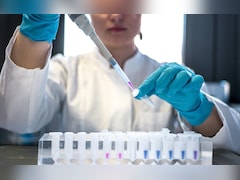 Siberia On Alert: Nearly 200 Isolated, Events Cancelled After Suspected Pneumonic Plague Death
