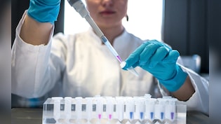 Siberia On Alert: Nearly 200 Isolated, Events Cancelled After Suspected Pneumonic Plague Death
