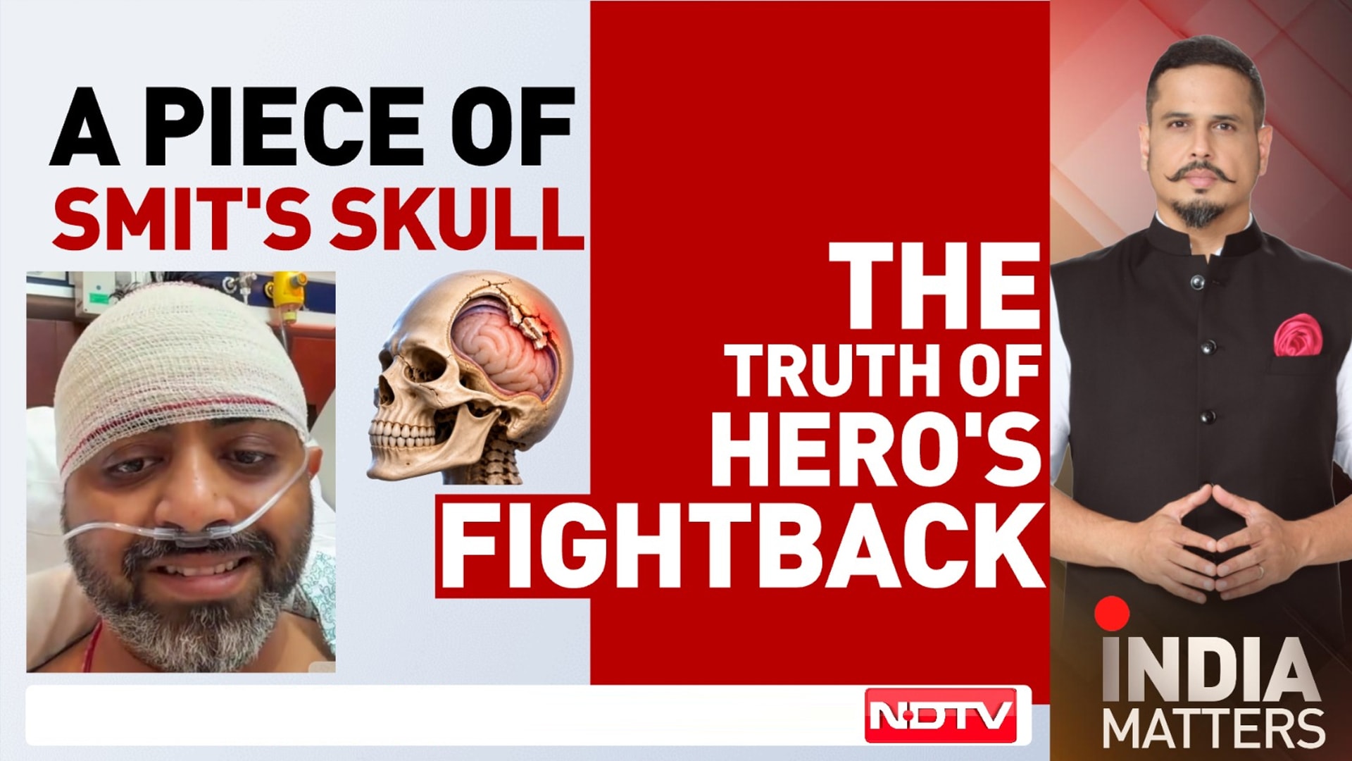 Smit's Skull Was Fractured: How Did He Still Save His Passengers?