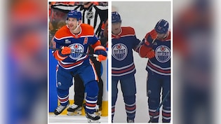 Edmonton Oilers&rsquo; Zach Hyman Expected To Miss At Least A Week After Head Injury