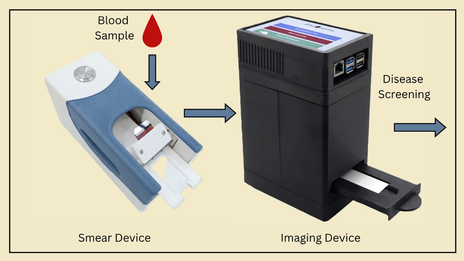 Devices developed by the researchers. Left: Smear device. Right: Imaging Device. Devices developed by the researchers. Left: Smear device. Right: Imaging Device.