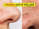 चेहरे के ब्लैकहेड्स कैसे साफ करें? नाक, ठुड्डी और माथे पर ब्लैकहेड्स हटाने के आसान तरीके