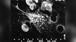 Scientists Develop Albumin-Based System To Produce Anticancer Compounds Inside Tumour Cells