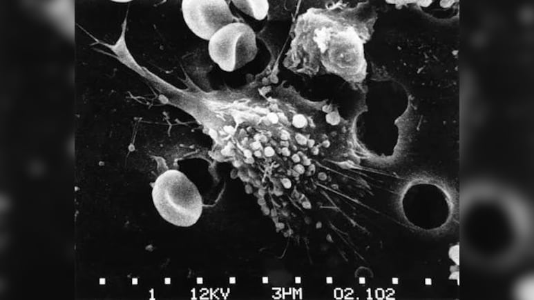 Scientists Develop Albumin-Based System To Produce Anticancer Compounds Inside Tumour Cells