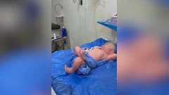 Egyptian Doctor Shares Video Of Newborn's Unusually Relaxed Pose, Amuses Internet