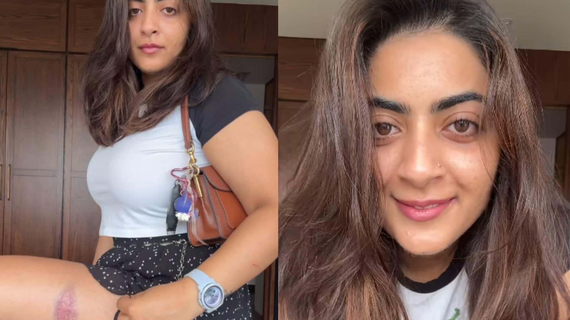 Aamir Khan's Niece Shares Video Of Injuries After Detention During CJP Protest